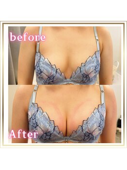 ジュエルリング(Jewel Ring)/バストアップ恵比寿・渋谷