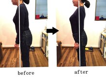 カナヤ鍼灸整骨院/姿勢矯正でスタイルアップ♪