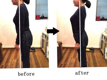 カナヤ鍼灸整骨院/姿勢矯正でスタイルアップ♪