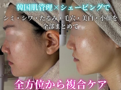 ハニエル(Haniel)の写真