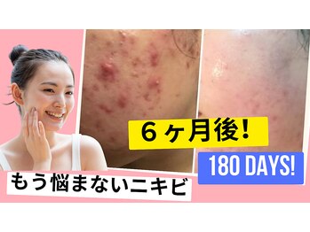 サロンドエクラ 南堀江(salon de eclat)