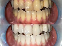 通い放題・都度払い・回数券とお好みの通い方で理想の白さへ