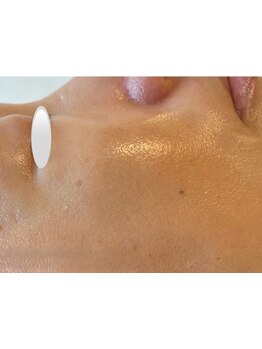 ハリツヤをUPしたい