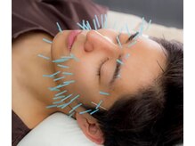 グラン治療院 東京/男の美容鍼灸 / メンズ美容鍼
