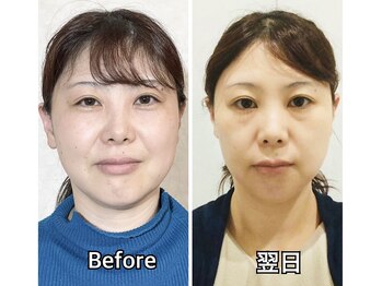 シンシア(SINCERE)の写真/お得な初回クーポンあり◎】その場しのぎではない！小顔矯正なのに優しい、優しい～タッチの施術です。