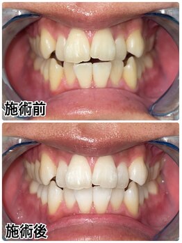 ホワイトニングビューティー 名古屋栄店(WHITENING BEAUTY)/セルフホワイトニング