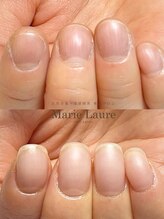 マリーロール 梅田店(Marie Laure)/自爪育成/深爪矯正/ネイルケア
