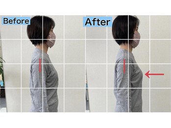 ディプロム(DIPROM)/【1回目】ビフォーアフター