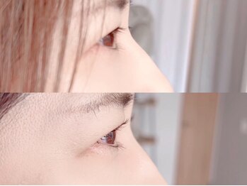 ニコ(nico)/まつげパー(上)