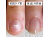【初回◎深爪・噛み爪改善】1回体験☆カウンセリング付