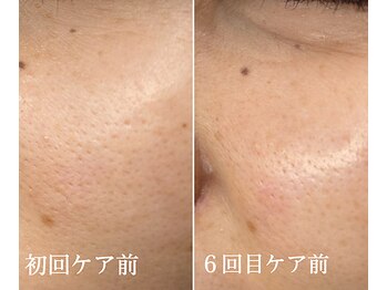 サイ(Sai)/before⇒after