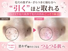 ピアリーノ(Pialino)