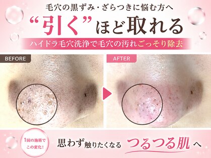 ピアリーノ(Pialino)の写真