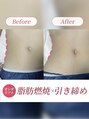 【小顔・痩身】小顔専門店Lift(リフト) 蒲田東口 美ボディ くびれ