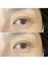 フランセス(Frances)/ラッシュリフト