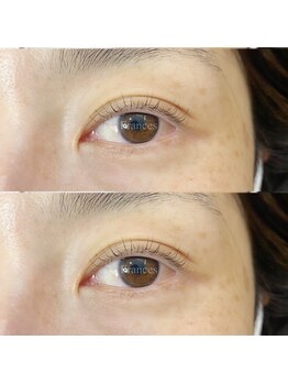 フランセス(Frances)/ラッシュリフト