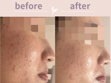 アール(R)/つや肌に！