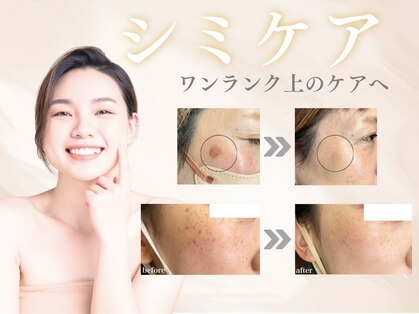レッドモート(Red moat)の写真