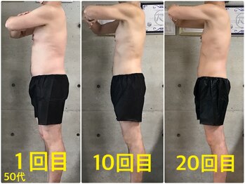 ペリー(PELLY)/男性50代 before after