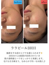 ユフラ(Juhla)/ララピール