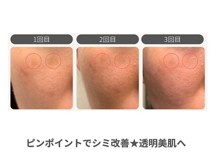 ソラ(Sola)の写真