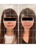 【小顔矯正】顔の筋肉コリと骨格の歪みにアプローチ★60分　￥16200→¥5500