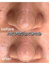 ルポアン(Repos an)/毛穴◎黒ずみ◎ざらつき◎