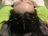 【鍼増量美容強化☆】美頭鍼×快眠美容ドライヘッドスパ50分　年内→¥7000