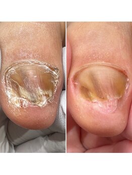 ハビッツ(habits)/どう頼んだらいい?