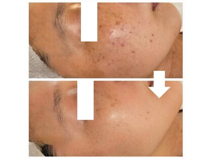 リセル(RE.cell)の写真