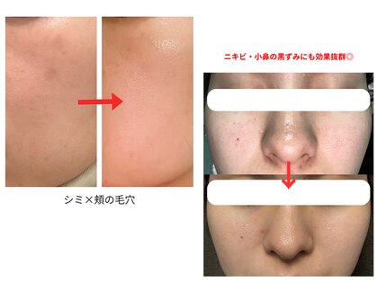 トモニ(TOMONI)の写真