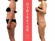 ムーン(MOON)/ 無理なく続く、キレイの近道