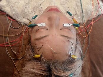 三国ヶ丘鍼灸整骨院/三国ケ丘産後整体/美容鍼灸