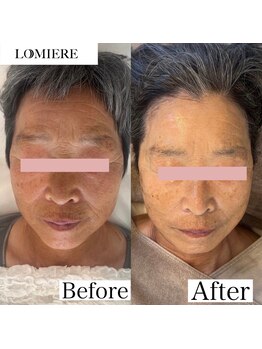 ロミエール(LOMIERE)/滋賀初！セルマン♪ ¥11000