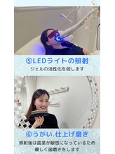 ホワイトニングショップ 新小岩店/施術手順【ホワイトニング】