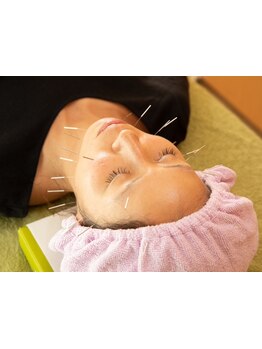 鍼灸施術を受けたい