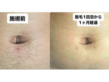 アレッド 大阪店(ared.)/意外と気になる？