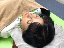 アポロ鍼灸マッサージ接骨院の雰囲気（人気No.1美容鍼！お客様のお悩みに合わせた施術をご提案！）