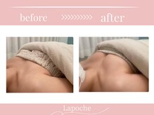 ラポッシュ(La poche)の雰囲気（バストアップ/バストケア/左右差/離れ乳/下垂/豊胸/広島）