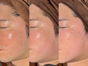 ルーナジェーナ(Luna llena)/