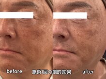 リエル(RIEL)/【美顔筋育成】