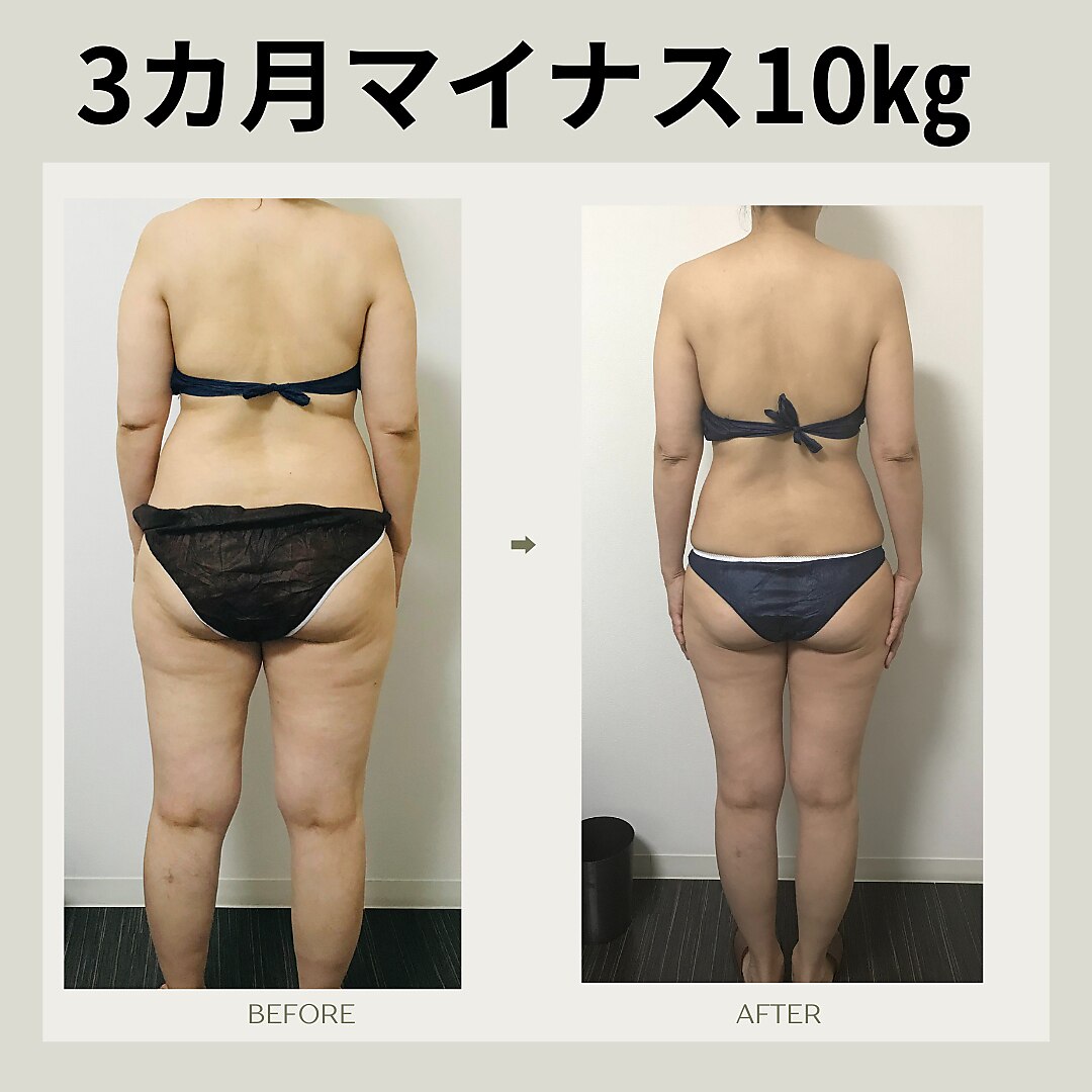 大阪市淀川区でキャビテーションが人気のエステサロン｜ホットペッパー