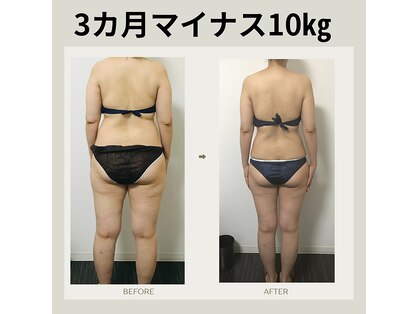 エステサロンクオーツの写真