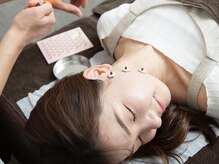 ボニー(Bonnie)/【美容鍼灸】