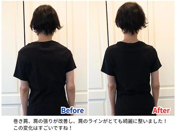 ラシュシュ/ビフォーアフター