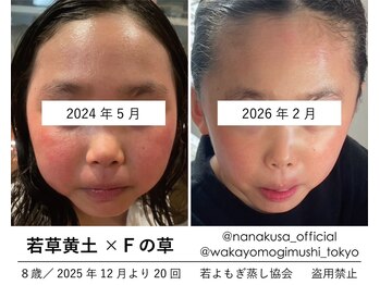 リレフー(Relafy)/お子様にも若よもぎ蒸し