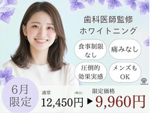 ホワイトニングカフェ 岡崎店(WhiteningCafe)の雰囲気(6月末までクーポン掲載中♪お得な機会をお見逃しなく~!)