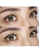 エメ(aimer)/バインドロック