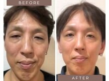 リノア 柏(Lino'a)/肌細胞が活性され若々しさup！