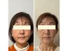 【60歳からの☆たるみケア】10年前の顔へ諦めなくて大丈夫　¥16500→10000